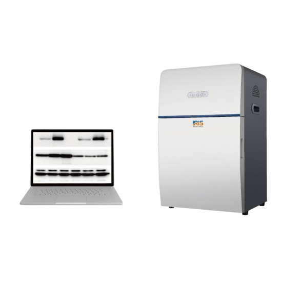 Gel Documentation System IGS-2010